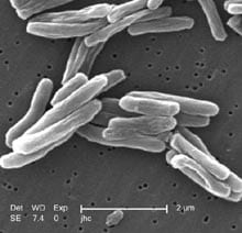 Mycobacterium_tuberculosis